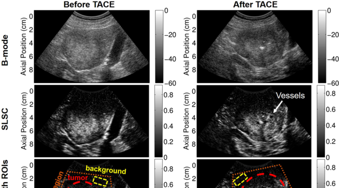 Understanding the Power of Diagnostic Ultrasound: A Comprehensive Guide